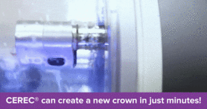 Gif of a working CEREC machine creating a crown