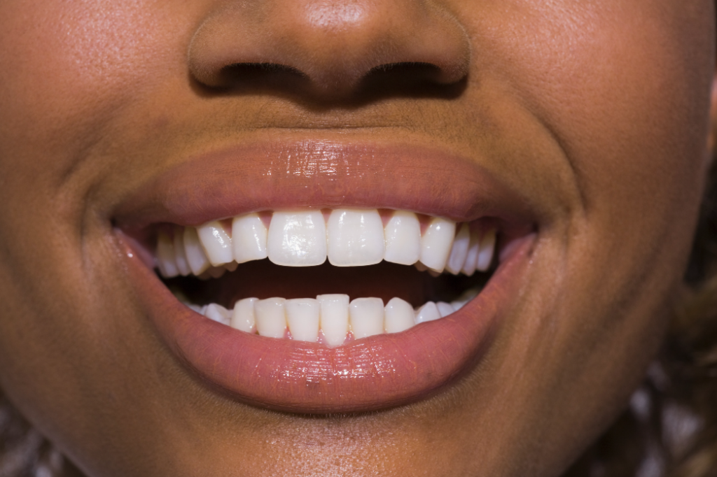 A woman shows off her white teeth with a smile, close-up
